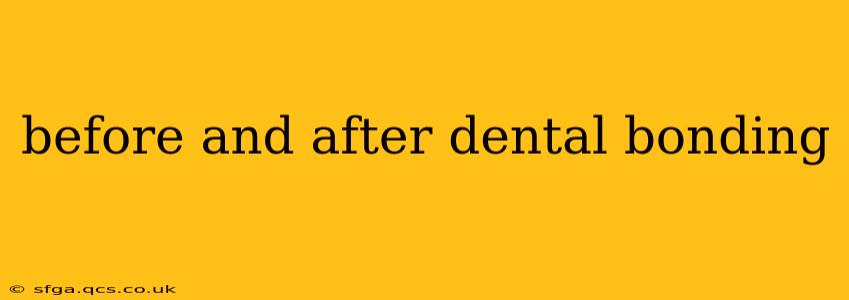 before and after dental bonding