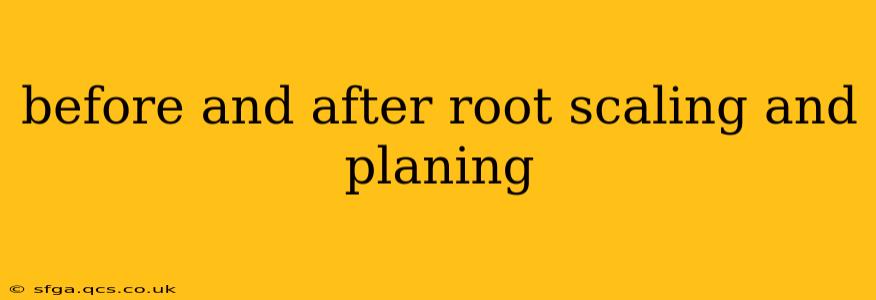 before and after root scaling and planing