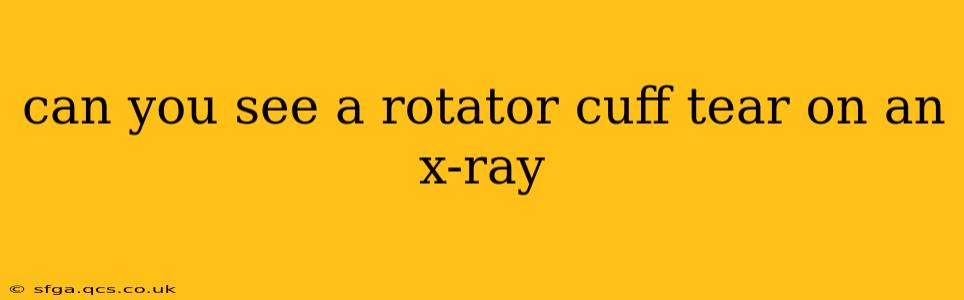 can you see a rotator cuff tear on an x-ray