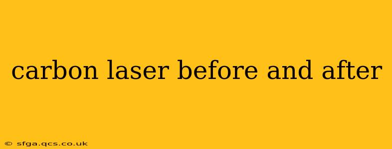 carbon laser before and after
