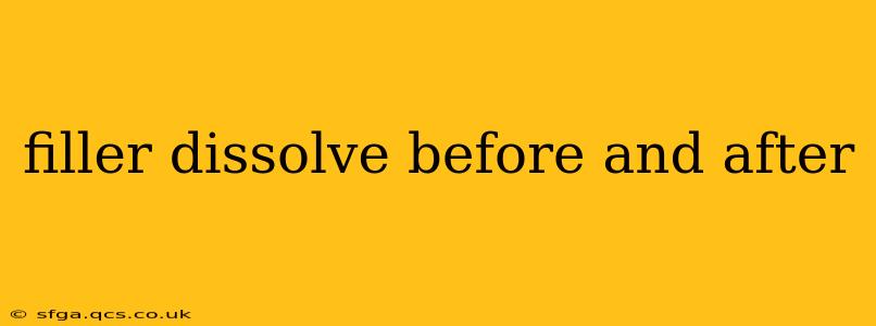 filler dissolve before and after