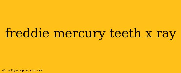 freddie mercury teeth x ray