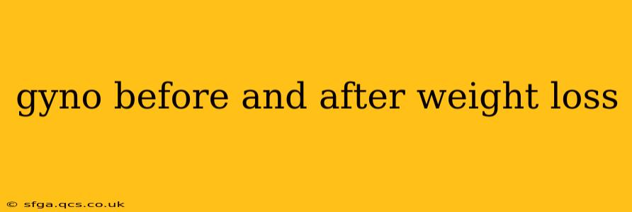 gyno before and after weight loss