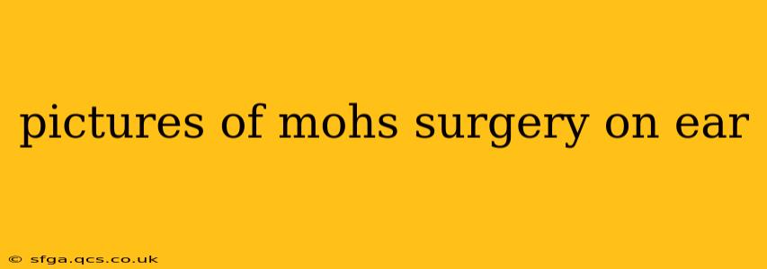 pictures of mohs surgery on ear