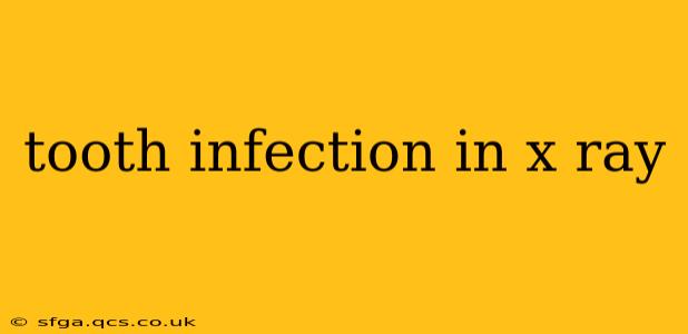 tooth infection in x ray