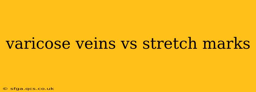 varicose veins vs stretch marks