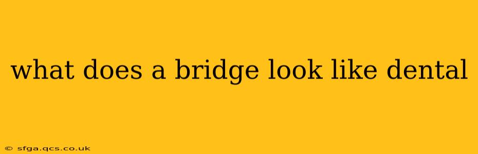what does a bridge look like dental