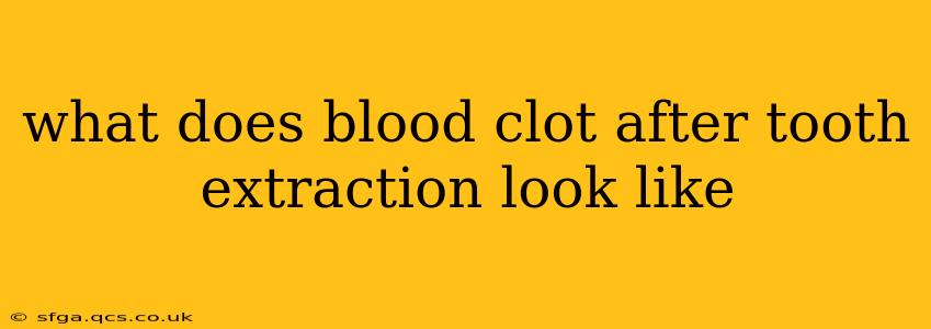 what does blood clot after tooth extraction look like