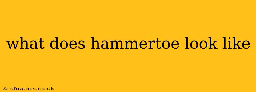 what does hammertoe look like