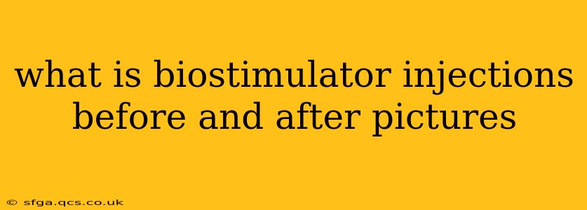 what is biostimulator injections before and after pictures