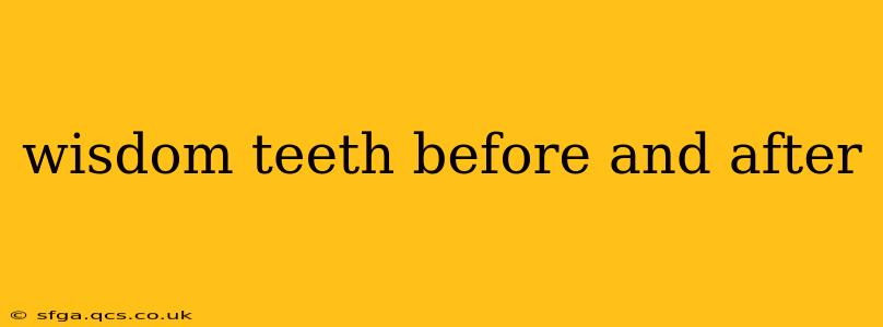 wisdom teeth before and after